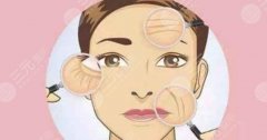 热玛吉要做几次才有果?超全科普来袭!领略抗衰C位的实力! 热玛吉要做几次才有果?超全科普来袭!领略抗衰C位的实力!
