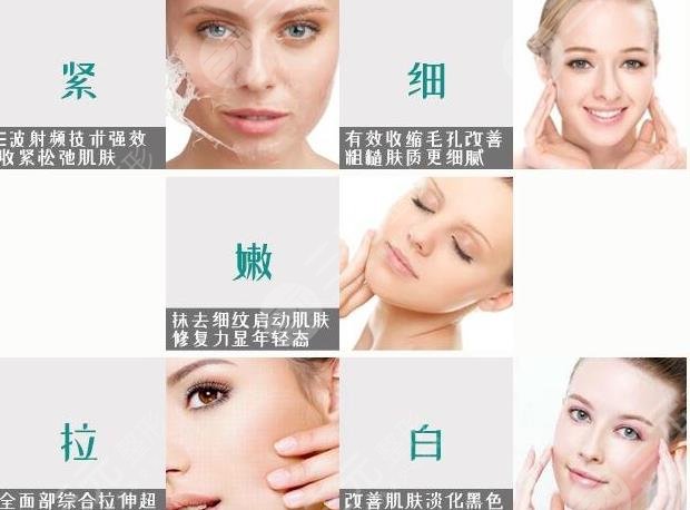 热玛吉