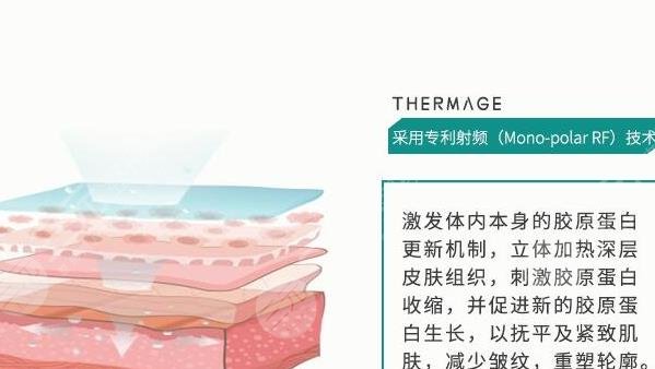 热玛吉