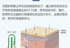 深蓝射频的作用原理&注意事项,亲民又白菜,这种抗衰医美别错过! 深蓝射频的作用原理&注意事项,亲民又白菜,这种抗衰医美别错过!