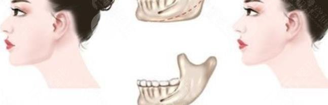 金一秀磨骨价格多少