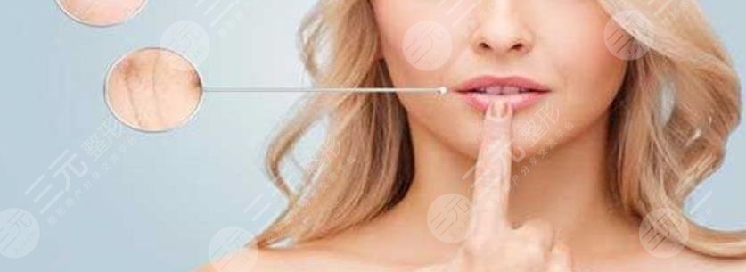 超声提拉去法令纹果怎么样