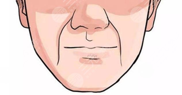 超声提拉去法令纹果怎么样