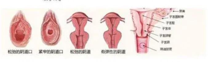 私密紧缩