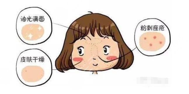 干货分享|干皮vs油皮、油痘肌VS油敏肌，四者如何区分？怎么改良？
