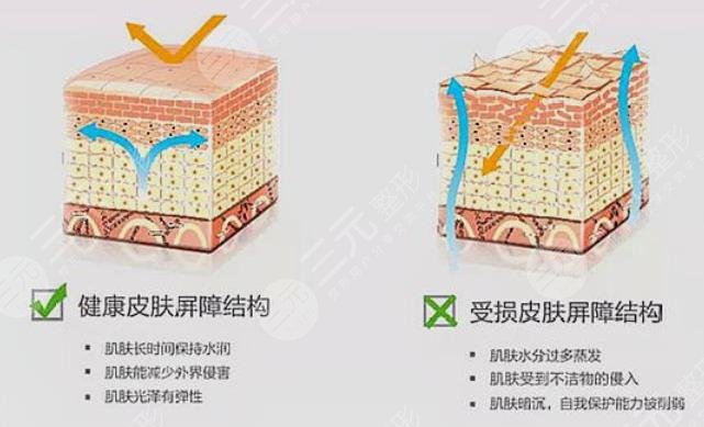 油痘肌VS油敏肌