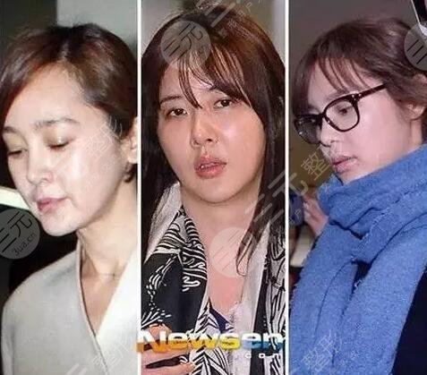 朴诗妍整容前后对比照被扒出,她曾是坠美"三圣母"