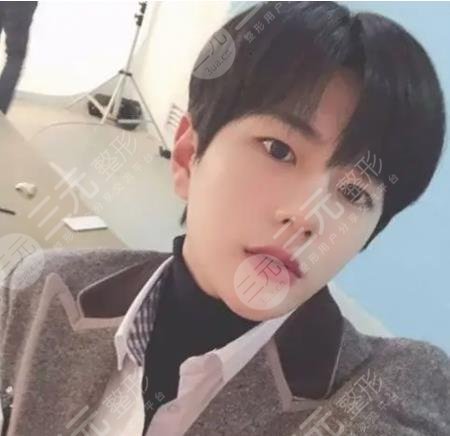 崔普闵整容实锤！00后韩团男爱豆整容失败换了张脸！他动了那里？