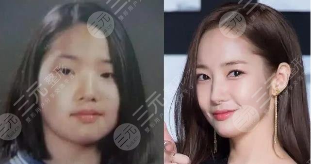 朴敏英整容史盘点!韩国‘换头式’整容女明星,承认自己动刀数次!