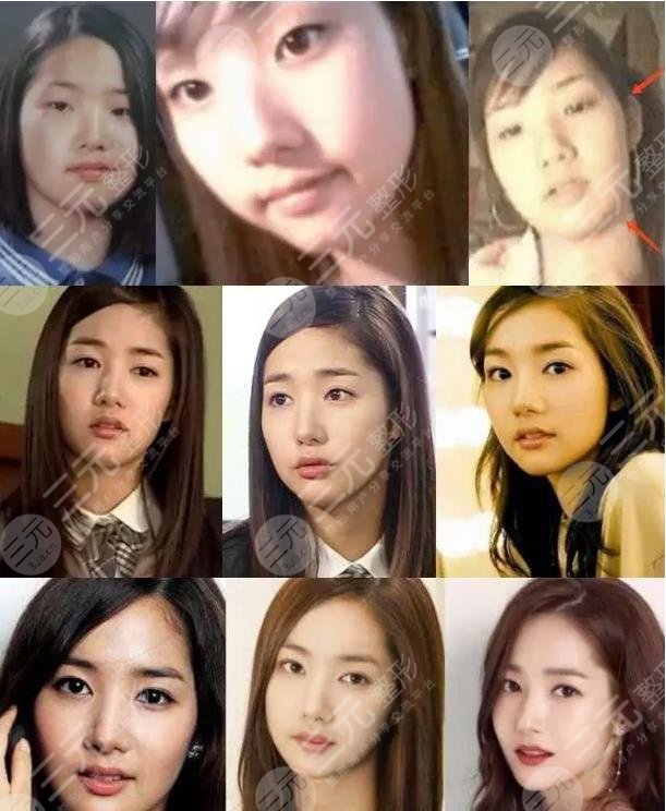 朴敏英整容史盘点韩国换头式整容女明星承认自己动刀数次
