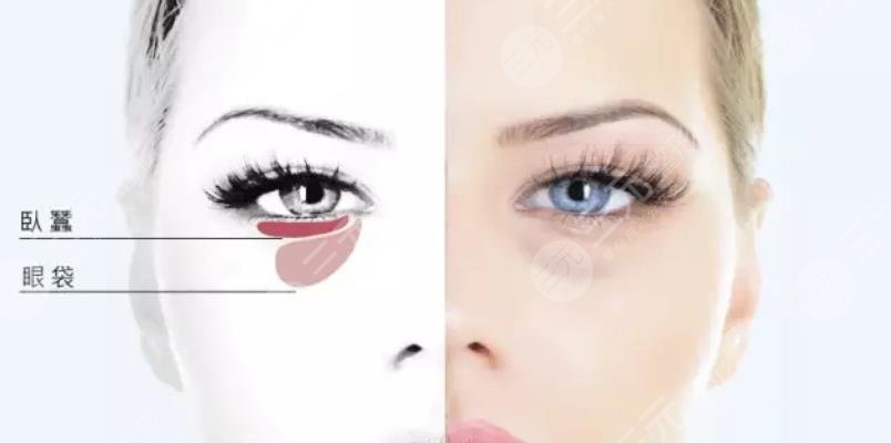 卧蚕?眼袋?傻傻分不清!卧蚕可以整出来吗?4种get方法分享~
