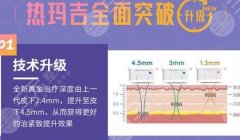 新一代热玛吉FLX一张脸打多少发,果怎么样?价格&术后指南get! 新一代热玛吉FLX一张脸打多少发,果怎么样?价格&术后指南get!