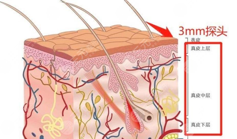 赛诺龙5gmax极速提拉