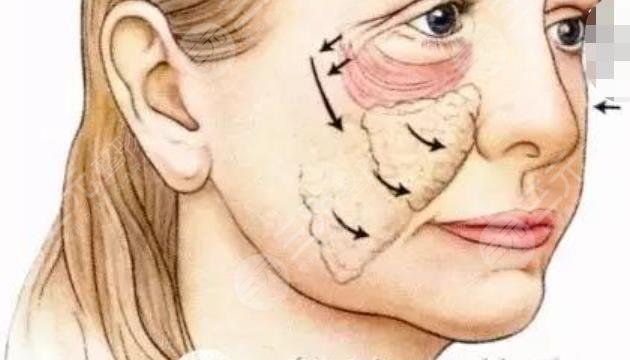 赛诺龙5gmax极速提拉