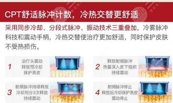 热玛吉