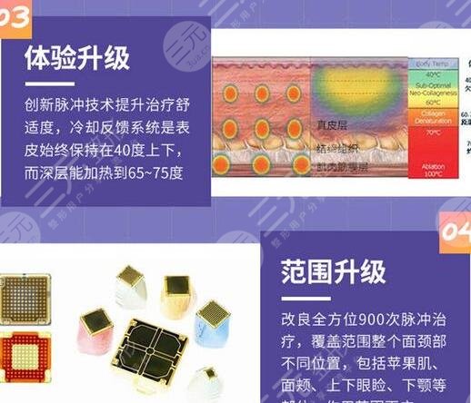 热玛吉