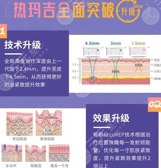 热玛吉