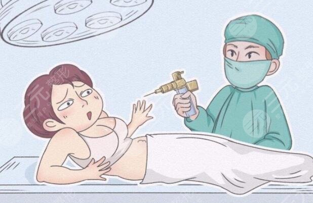 吸脂