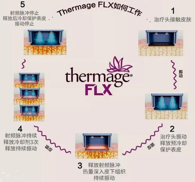 新一代热玛吉FLX仪器多少钱一次？功维持多久？2022美肤攻略！