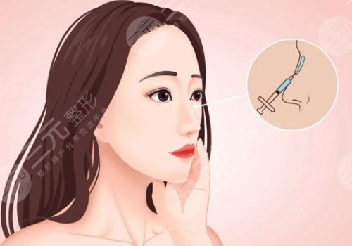 北京王军做鼻子很牛吗?医生技术真实点评+擅长项目展示