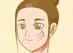 7d聚拉提果维持多久？南韩新款紧肤除皱设备，医美小课堂讲解！