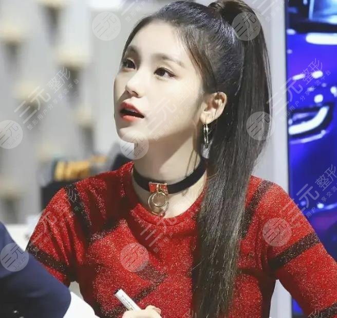 黄礼志Yeji“狐狸系”长相来源