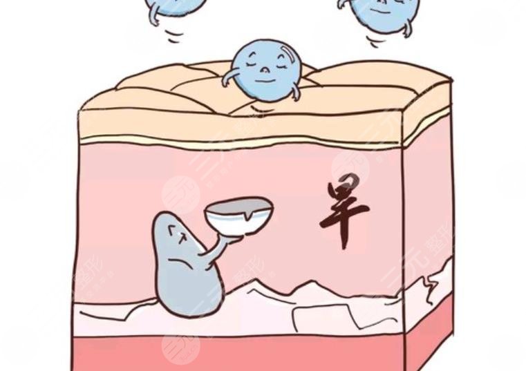 玻尿酸