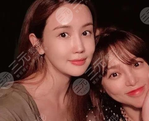 李多海整容多次变脸失败?成韩国整形反面教材!盘点她的整容历程