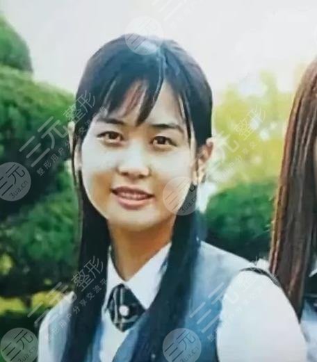 韩国整形反面教材李多海