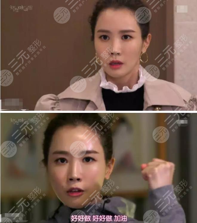 李多海整了那些地方?