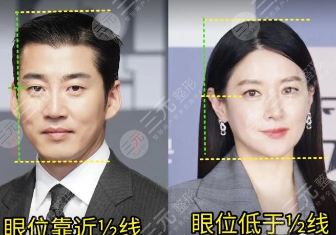 眼唇间距短 眼位低 皮和肉松垂占比double成熟也有有一种现象特别注意