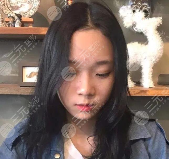 aespa金玟庭(winter)整容了吗?