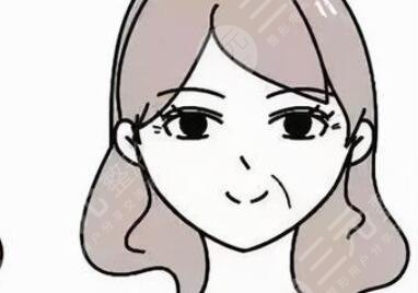 面部填充