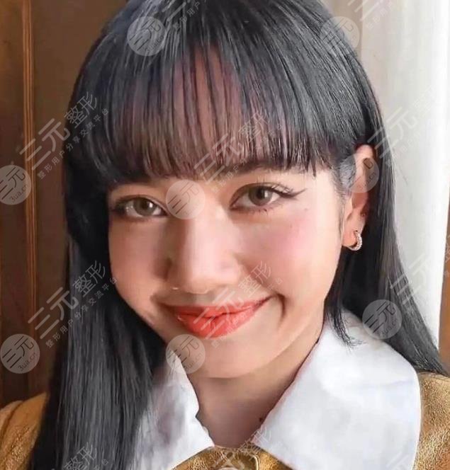 lisa整容了吗旧照露出被指整了鼻子这样也是人间芭比吗