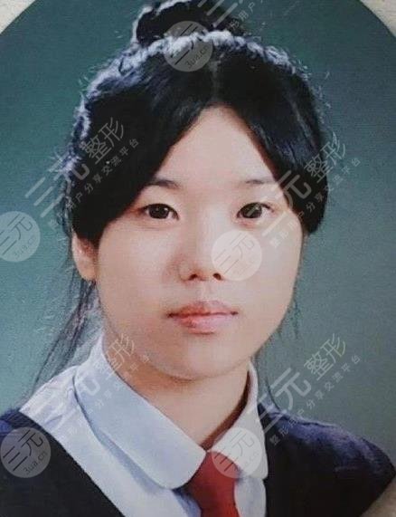 权恩妃整容了吗?