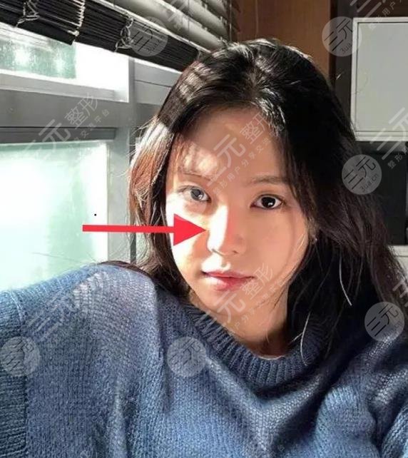 孙娜恩近照鼻子透光被网友热议整容失败？Apink门面就此陨落！