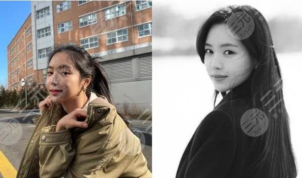 前Apink门面近照鼻子透光疑似整容失败?