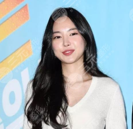 孙娜恩动了哪些地方?