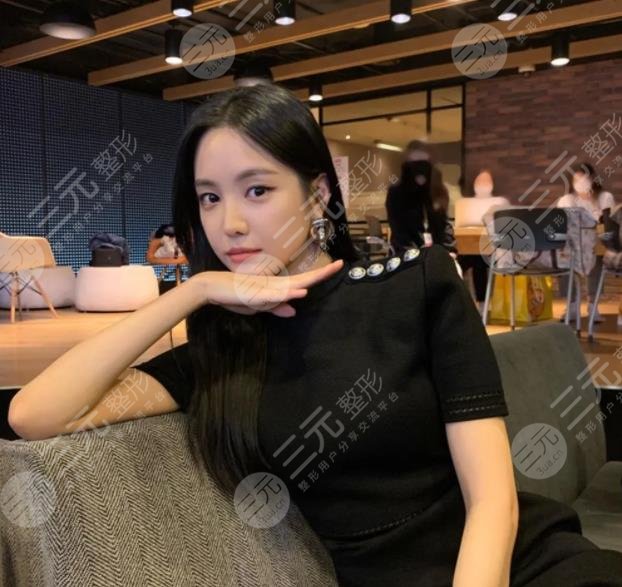 孙娜恩动了哪些地方?