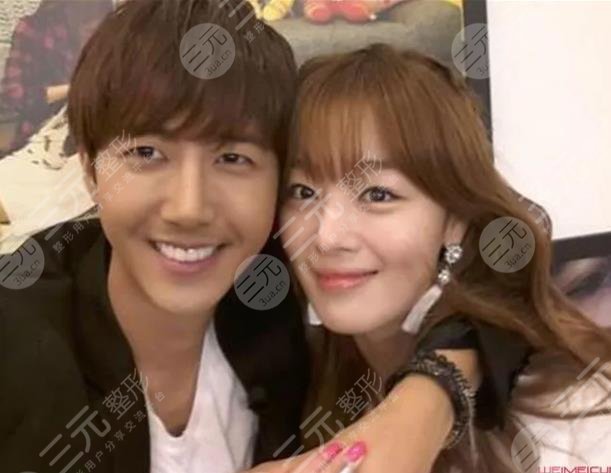 黄光熙整容历史盘点!