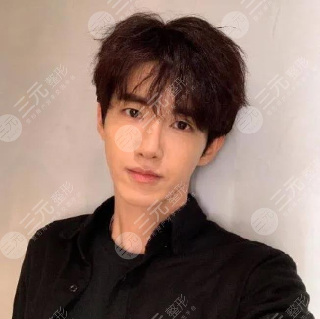 黄光熙整容失败男爱豆近照曝光！他再次在大众眼前“换头”成功！