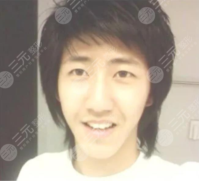 黄光熙整容历史盘点!