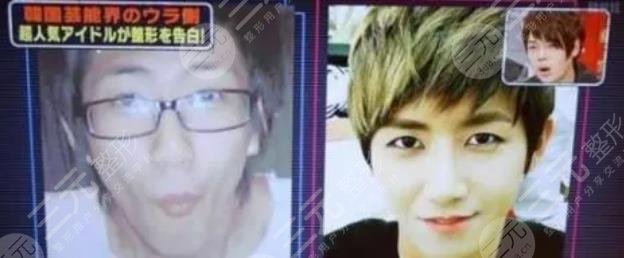 黄光熙整容历史盘点!