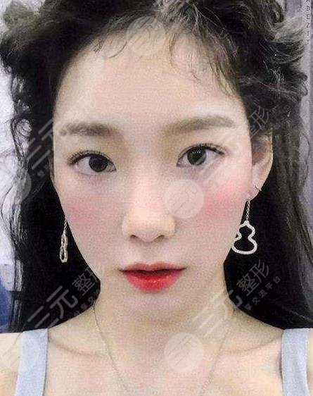 金泰妍有没有整容？多次整容现在脸崩了？鼻孔一大一小疑似隆鼻失败？
