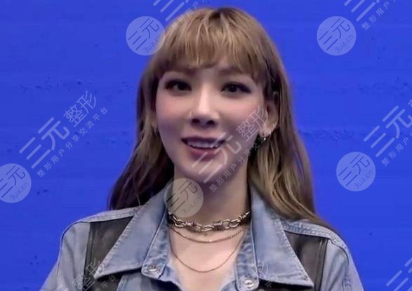 金泰妍有没有整容多次整容现在脸崩了鼻孔一大一小疑似隆鼻失败