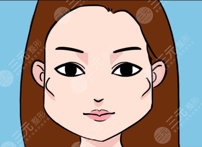 改脸型多少钱 下颌角磨削改脸型真人案例分享