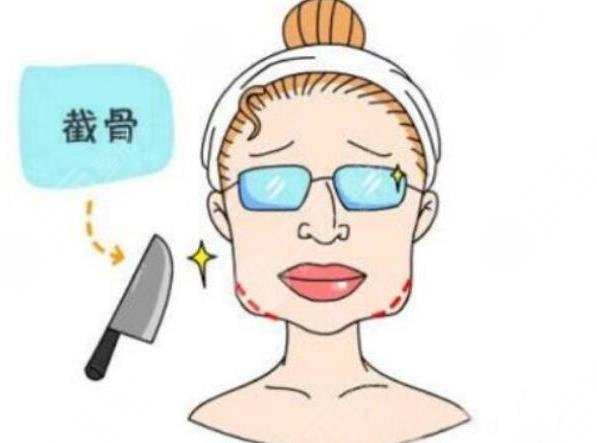 改脸型多少钱 下颌角磨削改脸型真人案例分享