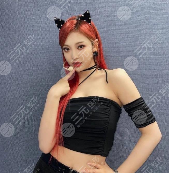 aespa宁艺卓整容过吗?