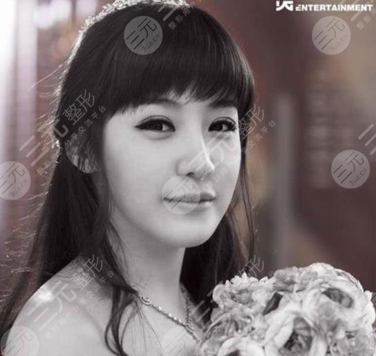 朴春变脸成“怪物”?她动了哪些地方?