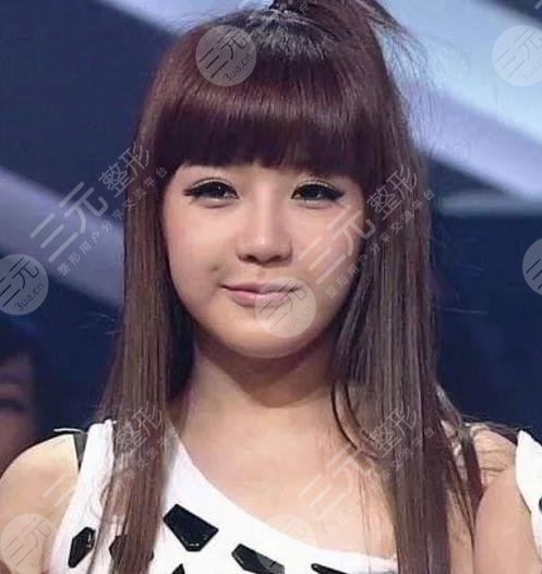 朴春变脸成“怪物”?她动了哪些地方?